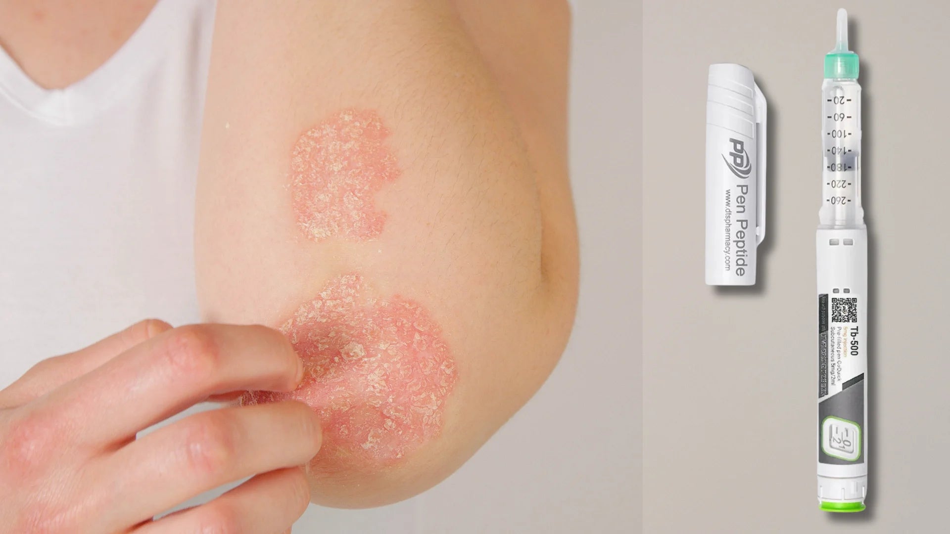 Пептиды в лечении кожных заболеваний