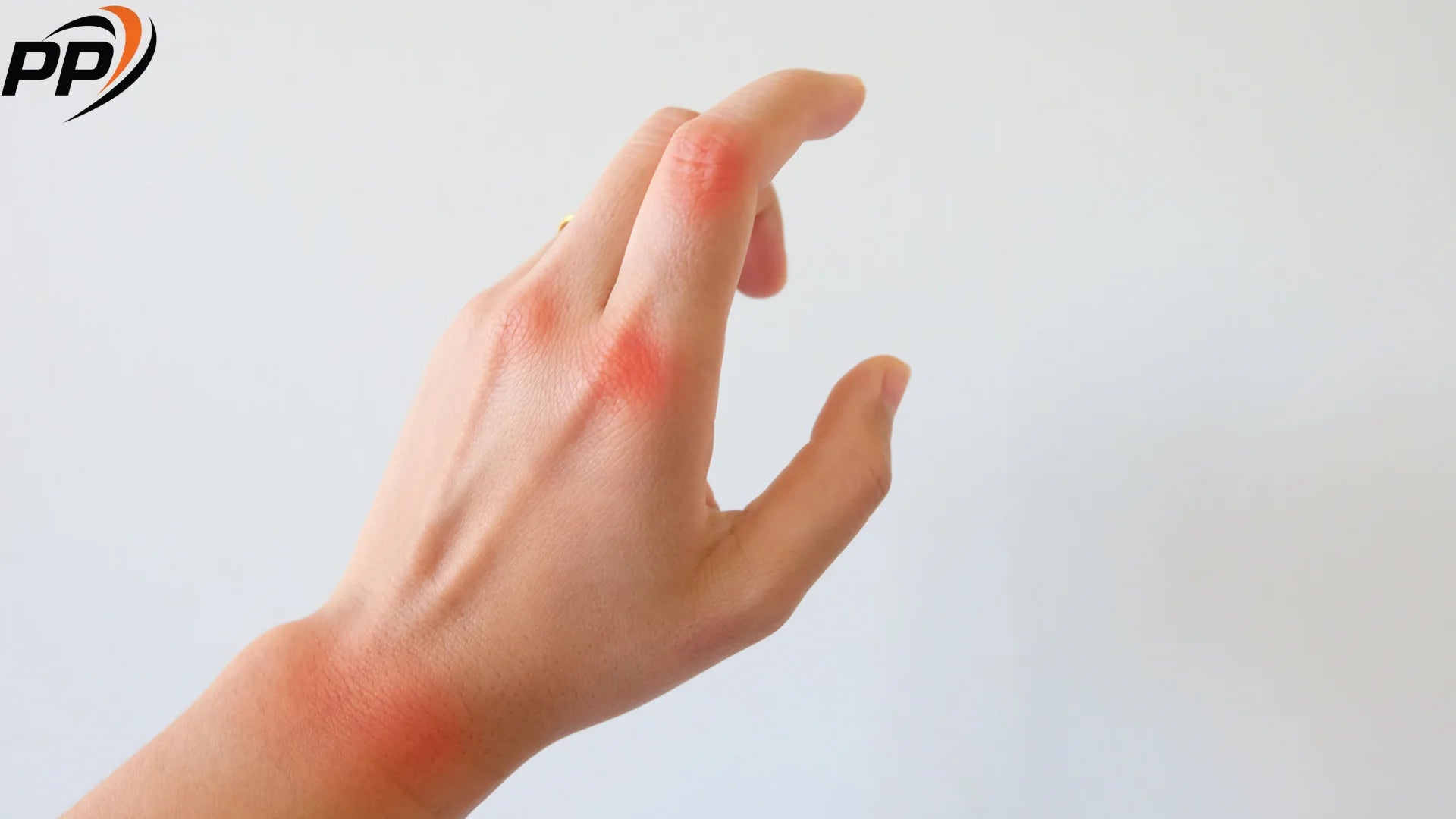 Кои органи и системи са засегнати от ревматоиден артрит